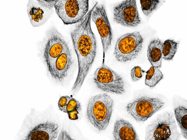 tisbio 2017 UGSF V3opti